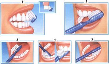 Obrázok zobrazujúci správnu techniku čistenia zubov a používanie zubnej nite.