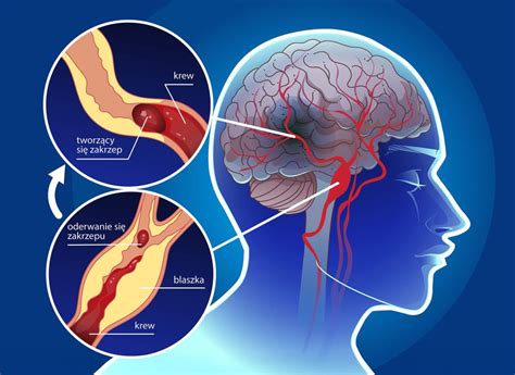 Infografika znázorňujúca rast mozgu dieťaťa a kľúčové živiny potrebné pre jeho vývoj