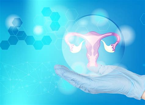 Schematické znázornenie správneho zavedenia Mireny do maternice