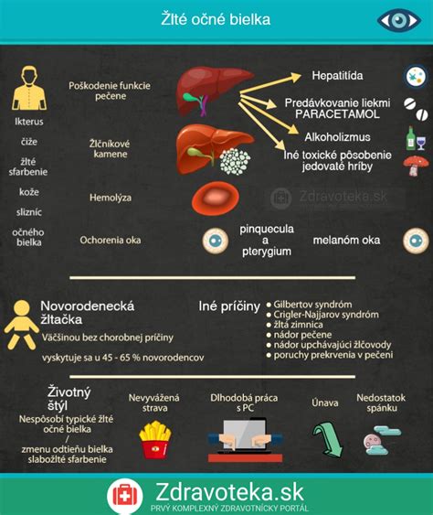 Infografika zobrazujúca najčastejšie príčiny popôrodných komplikácií
