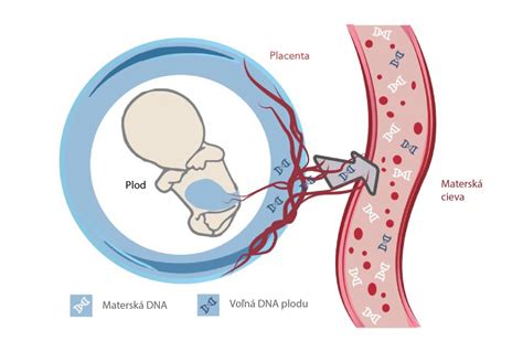 Ilustrácia zobrazujúca fragmenty DNA plodu v krvi matky.