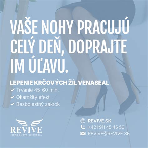 vizuálne znázornenie štruktúry žíl a vzniku varixov