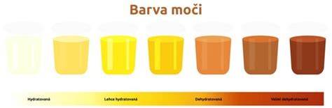 Infografika porovnávajúca rôzne farby nosového sekrétu a ich potenciálny význam