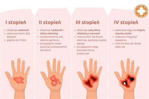 infografika s príznakmi infekcie rany