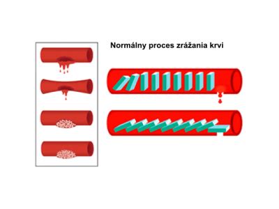 schéma mechanizmu zrážania krvi