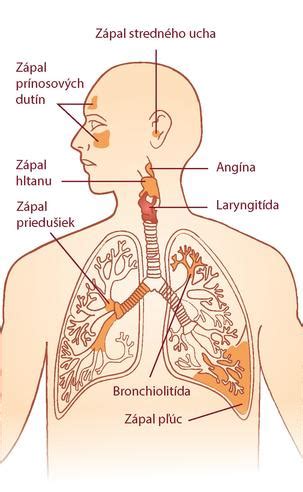Ilustrácia pľúc dieťaťa s vyznačenými alveolami