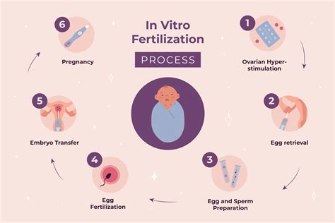 Infografika znázorňujúca proces schvaľovania a preplácania IVF v zahraničí.