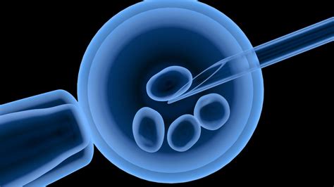 Schéma procesu oplodnenia in vitro (IVF)