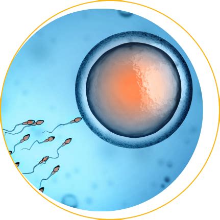 Ilustrácia znázorňujúca proces IVF od odberu vajíčka a spermií až po prenos embrya do maternice.