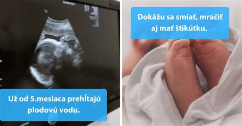 Ilustrácia znázorňujúca vývoj mozgu dieťaťa v maternici