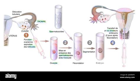 Schéma in vitro modelu diferenciácie trofoblastu