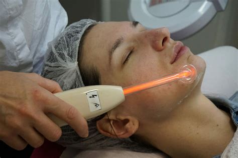 Ilustrácia znázorňujúca aplikáciu ultrazvuku na tvár pri kozmetickom ošetrení