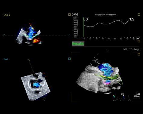 Schematické znázornenie merania hĺbky mora pomocou ultrazvuku.