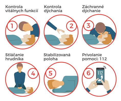 Infografika s krokmi prvej pomoci pri úraze hlavy dieťaťa