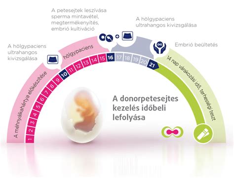 Infografika znázorňujúca jednotlivé kroky IVF cyklu.