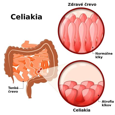 Schematické znázornenie gastrulácie a vzniku zárodočných listov.