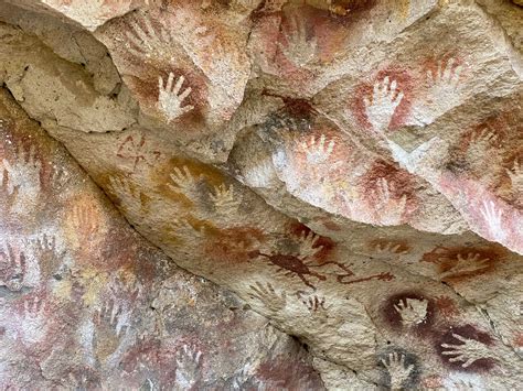 Ilustračná fotografia detských rúk s vyrážkami