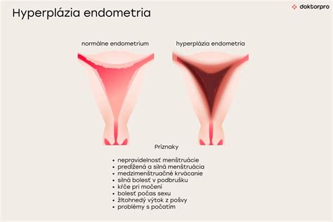 Ilustrácia sliznice maternice (endometria)