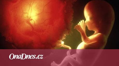 Schéma prenosu CMV z matky na plod