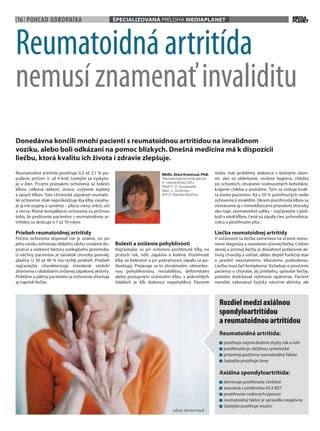Ilustračná fotografia ženy s reumatoidnou artritídou v tehotenstve