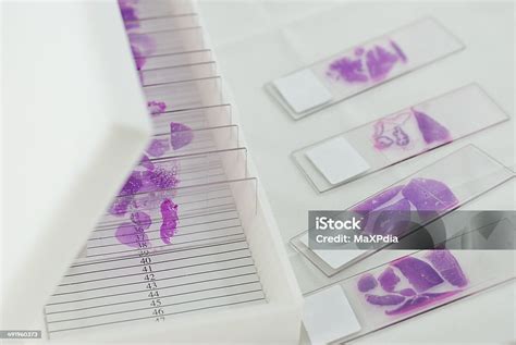 laboratórne sklíčko s močom a mikroskopom, symbolizujúce diagnostiku