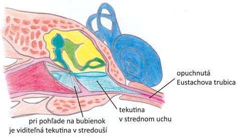 Ilustrácia ľudského ucha s vyznačenou Eustachovou trubicou
