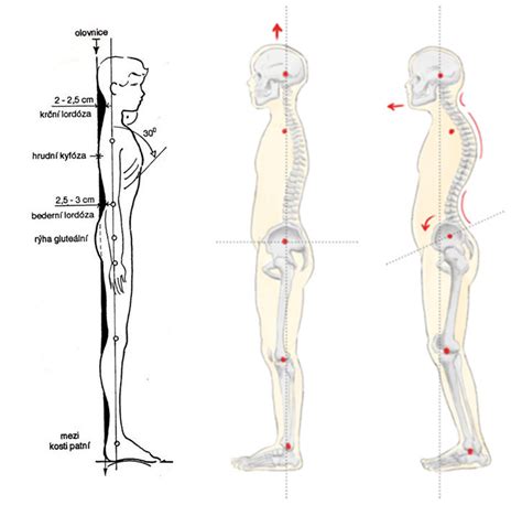 Ilustrácia znázorňujúca správne a nesprávne polohovanie dieťaťa