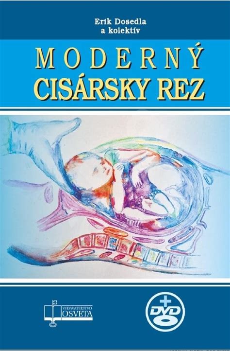 Ilustrácia znázorňujúca cisársky rez