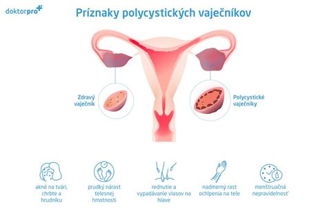Infografika zobrazujúca fázy hormonálnej stimulácie vaječníkov