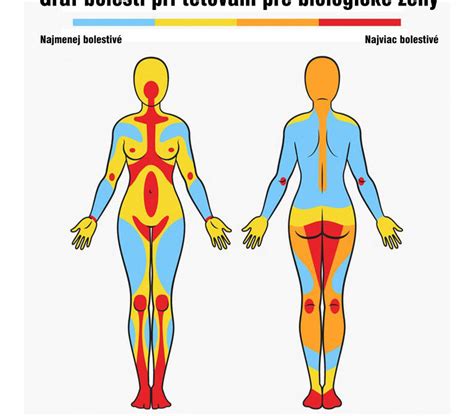 Ilustrácia oblasti podbruška s vyznačením miesta možnej ovulačnej bolesti.