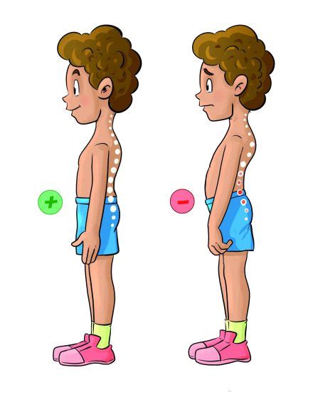 ilustrácia správneho a nesprávneho držania tela dieťaťa
