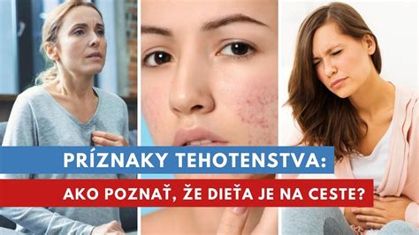 Ilustrácia znázorňujúca rôzne skoré príznaky tehotenstva