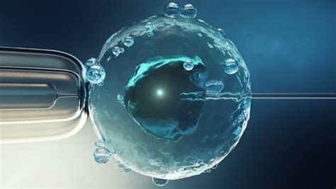 Ilustrácia procesu odberu vajíčok pri IVF