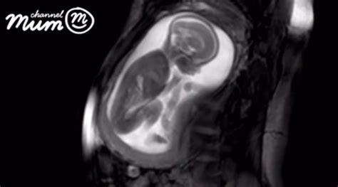 Ilustrácia zobrazujúca matku a dieťa v maternici, symbolizujúca prepojenie a komunikáciu cez hormóny a podnety.