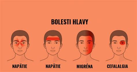 grafické znázornenie typov bolestí hlavy