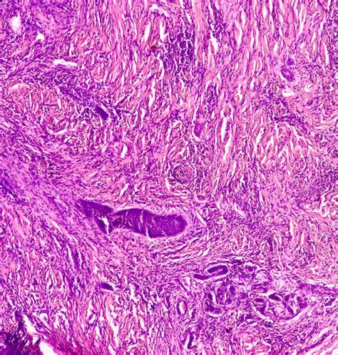 Mikroskopický obraz slín počas plodného obdobia ženy, s viditeľnou kryštalickou štruktúrou pripomínajúcou papraď.