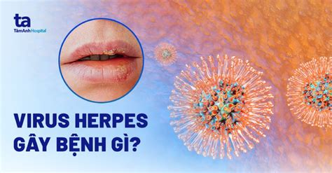 infografika znázorňujúca spôsoby prenosu vírusu herpes simplex