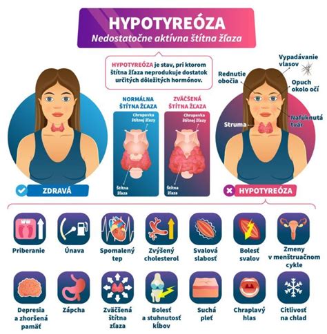 infografika porovnávajúca príznaky hypertyreózy a hypotyreózy
