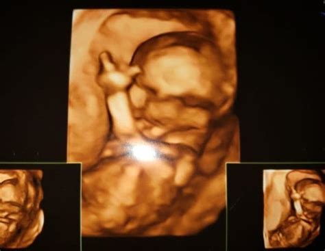 Ilustračná fotografia usmievavého bábätka zobrazeného na 4D ultrazvuku.