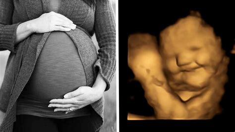 Ilustračné foto bábätka v brušku matky.