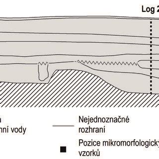 schematické znázornenie kĺbu s vyznačenými kosťami, chrupavkami a väzmi