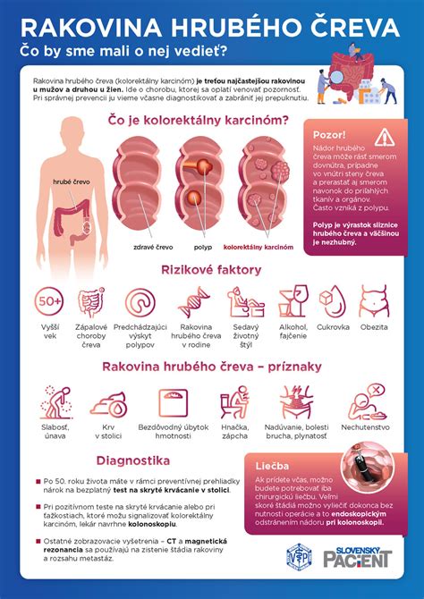 Infografika zobrazujúca odporúčané a nevhodné potraviny pri zápale hrubého čreva.