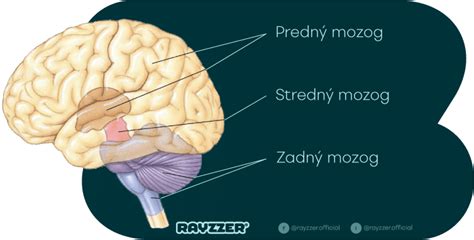 Ilustrácia znázorňujúca mozog v lebke a mechanizmus otrasu pri náraze