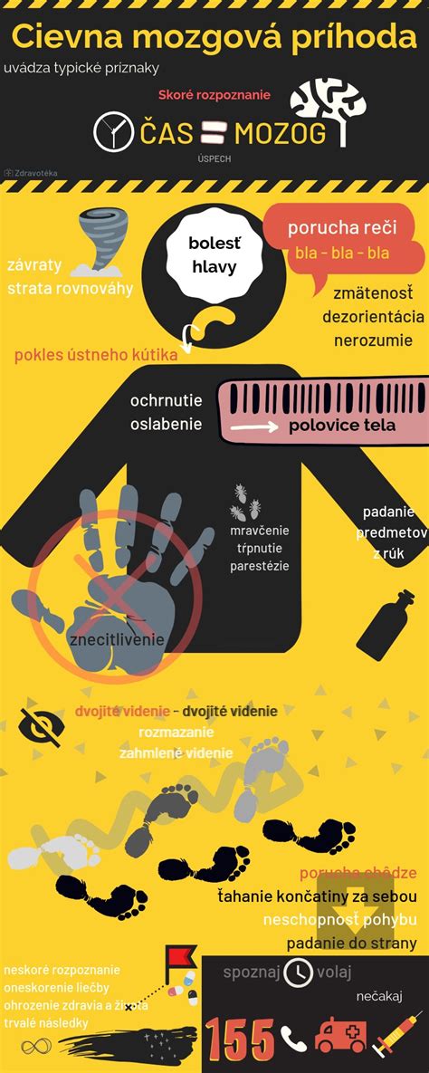 infografika znázorňujúca proces podpory životných funkcií v prípade mozgovej smrti