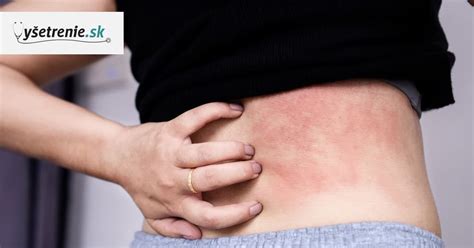 Schéma zobrazujúca