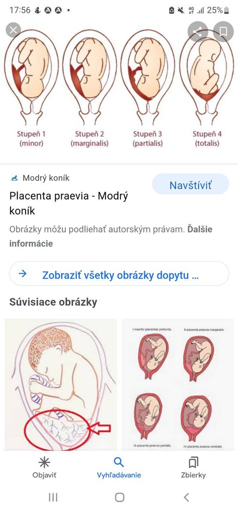 Štruktúra panvy sučky a pôrodných ciest