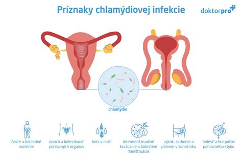 infografika zobrazujúca rôzne príznaky kvasinkovej infekcie
