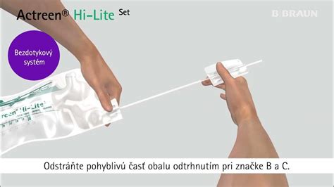 Ilustrácia zavedenia spermií do maternice pomocou katétra.
