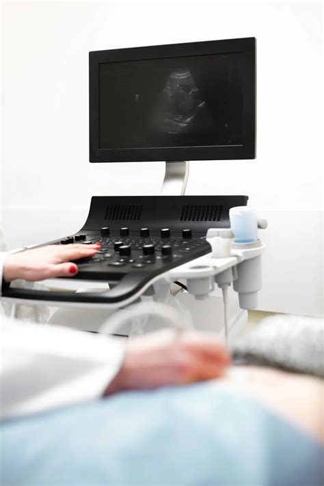 Ilustračná fotografia zobrazujúca ultrazvukové vyšetrenie plodu v maternici.