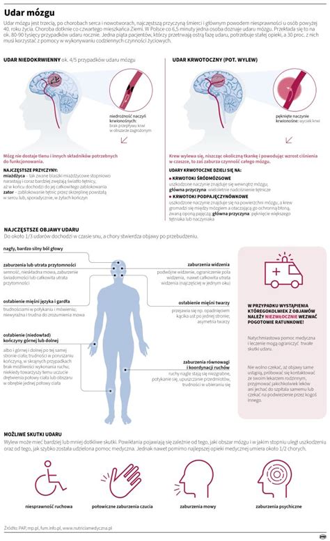 Infografika s varovnými signálmi otrasu mozgu u detí.